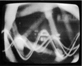 Frame from Syntheses: with oscilloscope display of sound and video feedback..